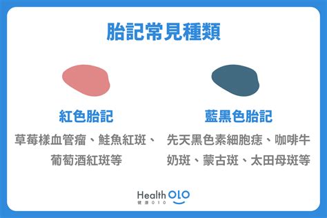 額頭胎記|胎記怎麼產生、何時消除？醫師剖析胎記種類、胎記寓意